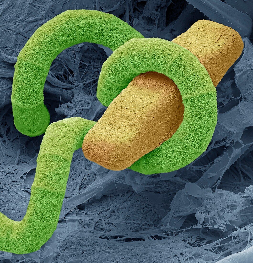 Spirulina cyanobacteria and a diatom,SEM