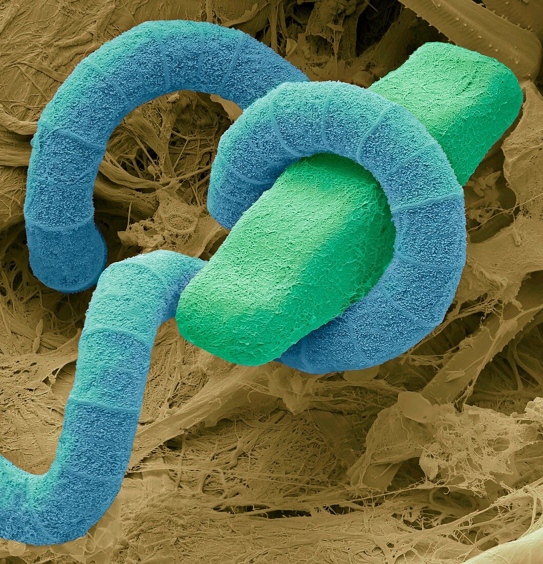 Spirulina cyanobacteria and a diatom,SEM