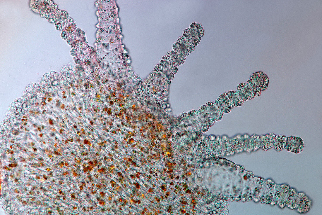 Hydra,light micrograph