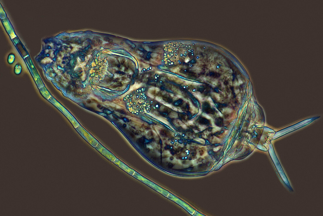 Euchlanis rotifer,light micrograph
