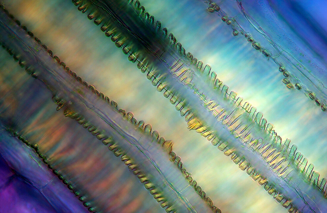 Lovage stalk,light micrograph