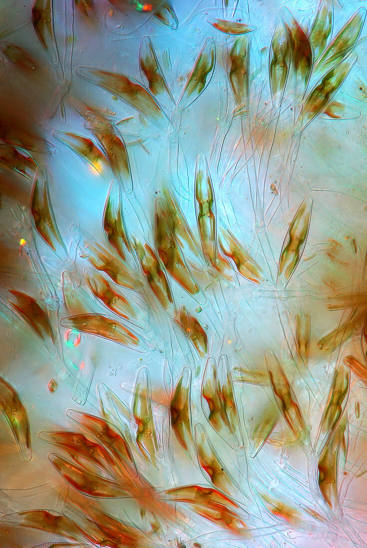 Cymbella diatoms,light micrograph