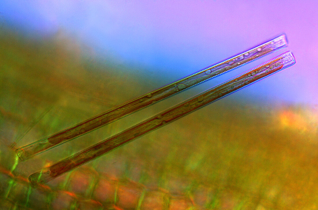 Synedra diatoms,light micrograph