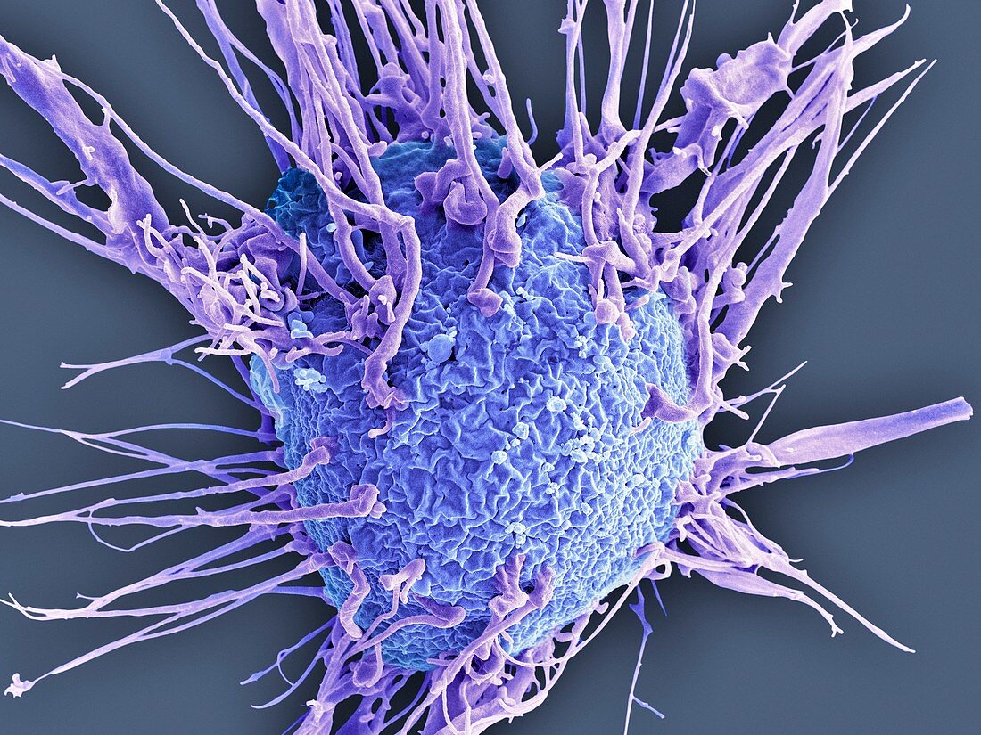 Breast cancer cell,SEM