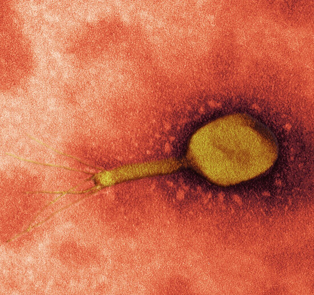 T4 bacteriophage virus,TEM