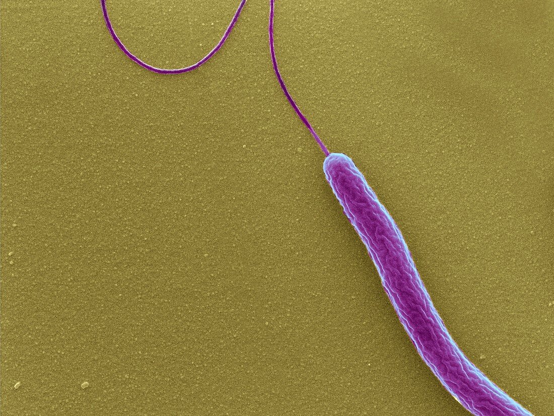 Cholera bacterium,SEM