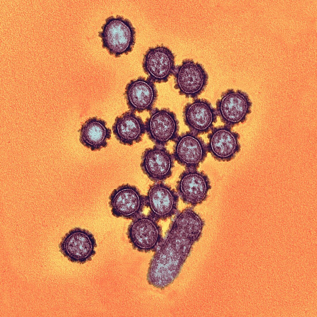 H1N1 flu virus particles,TEM