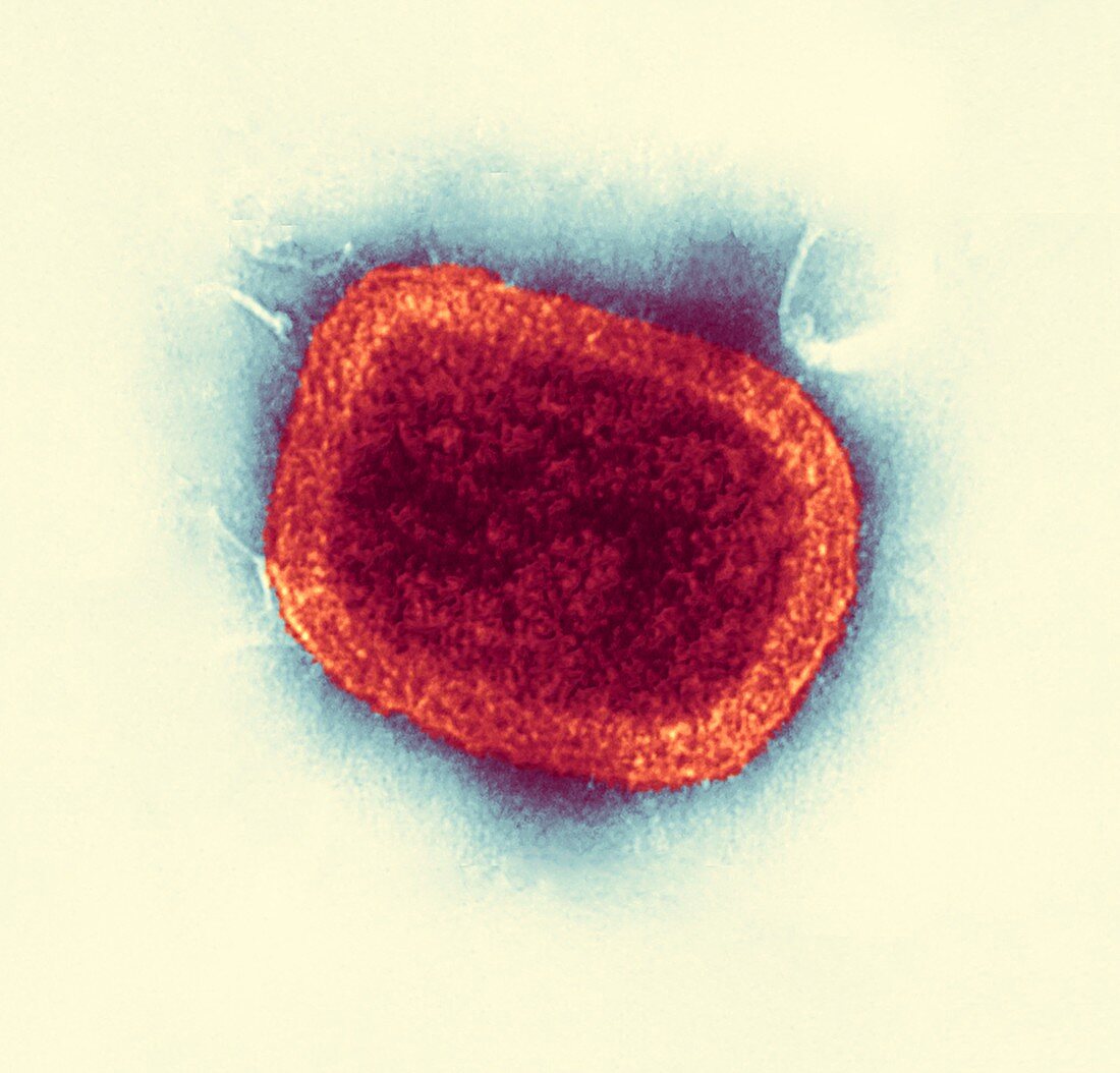 Smallpox virus particle,TEM