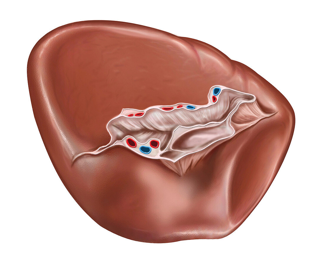 The Spleen,illustration
