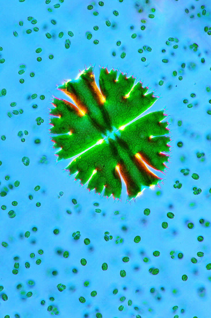 Desmid and chlorophytes,micrograph