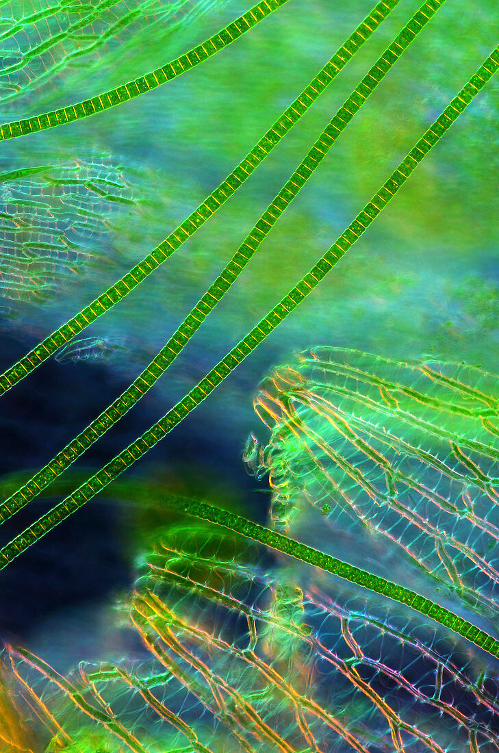 Desmids on sphagnum moss,micrograph