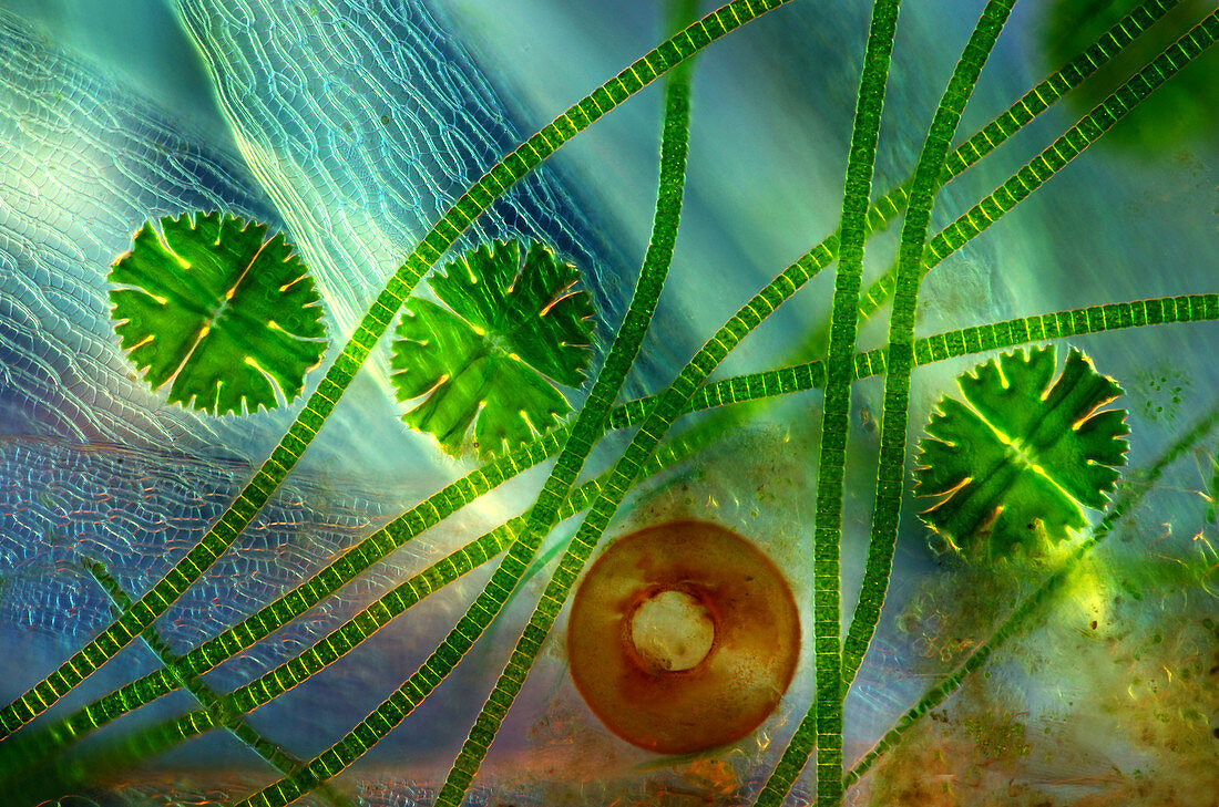 Desmids and shelled amoeba,micrograph