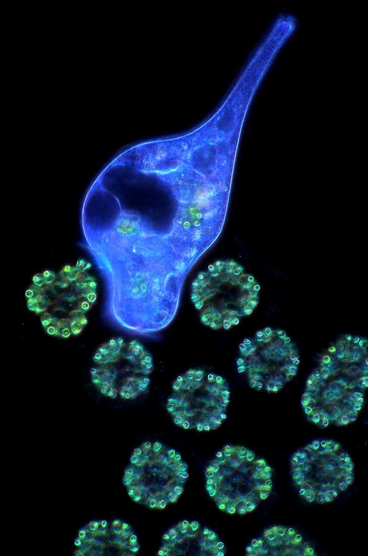 Protozoan and Dictyosphaerium green algae