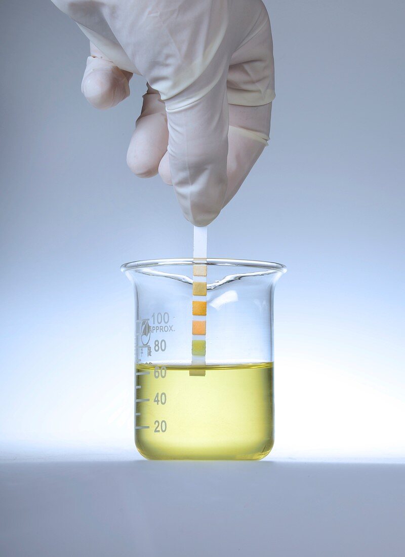 Home urine test