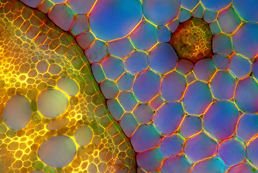 Fern stem,light micrograph