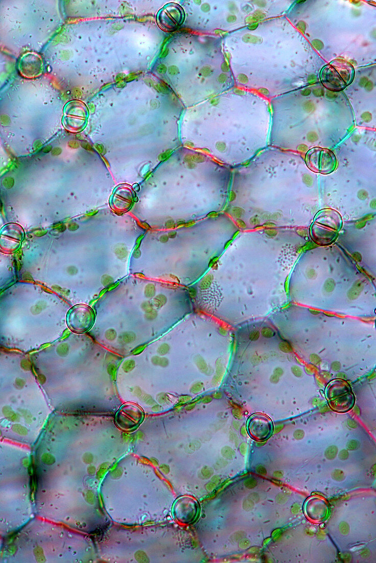 Bladderwort trap,light micrograph