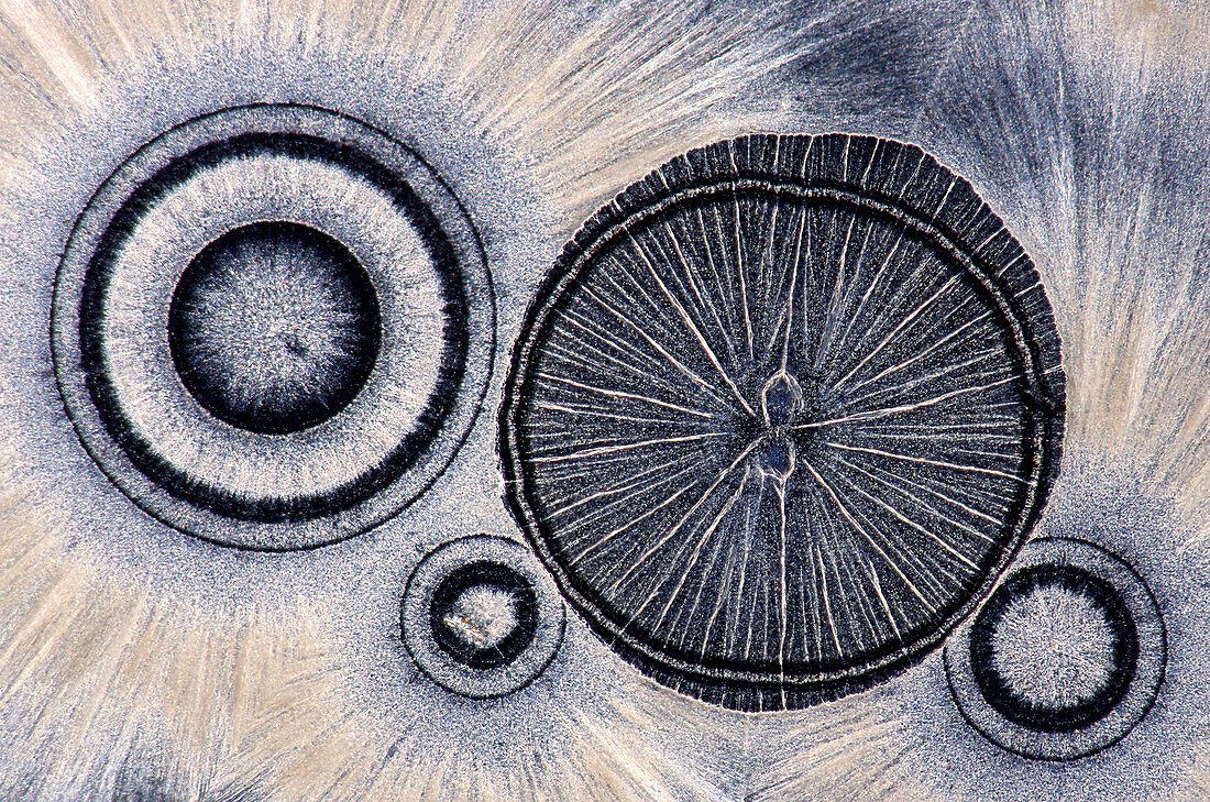 EDTA crystals,light micrograph
