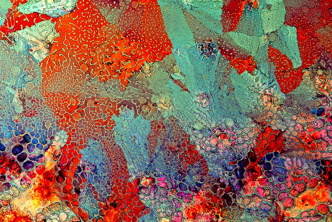 Haematoxylin crystals,light micrograph