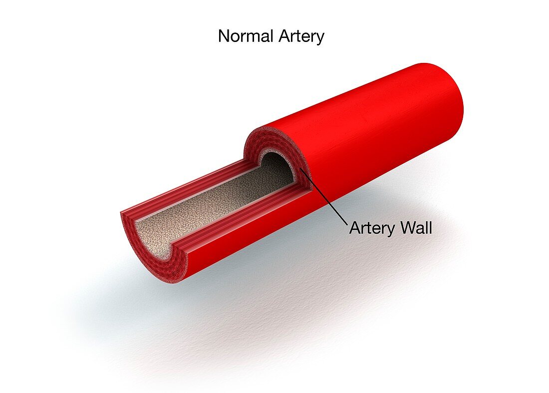 Normal artery anatomy,illustration