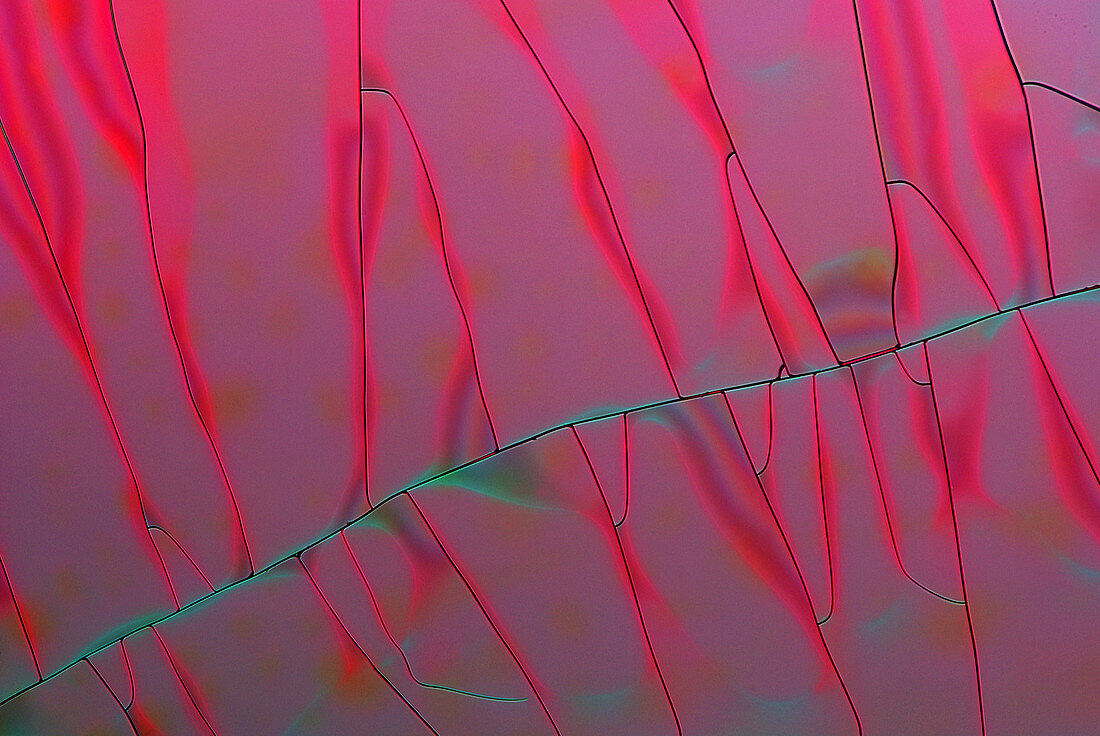 Tannic acid crystals,light micrograph