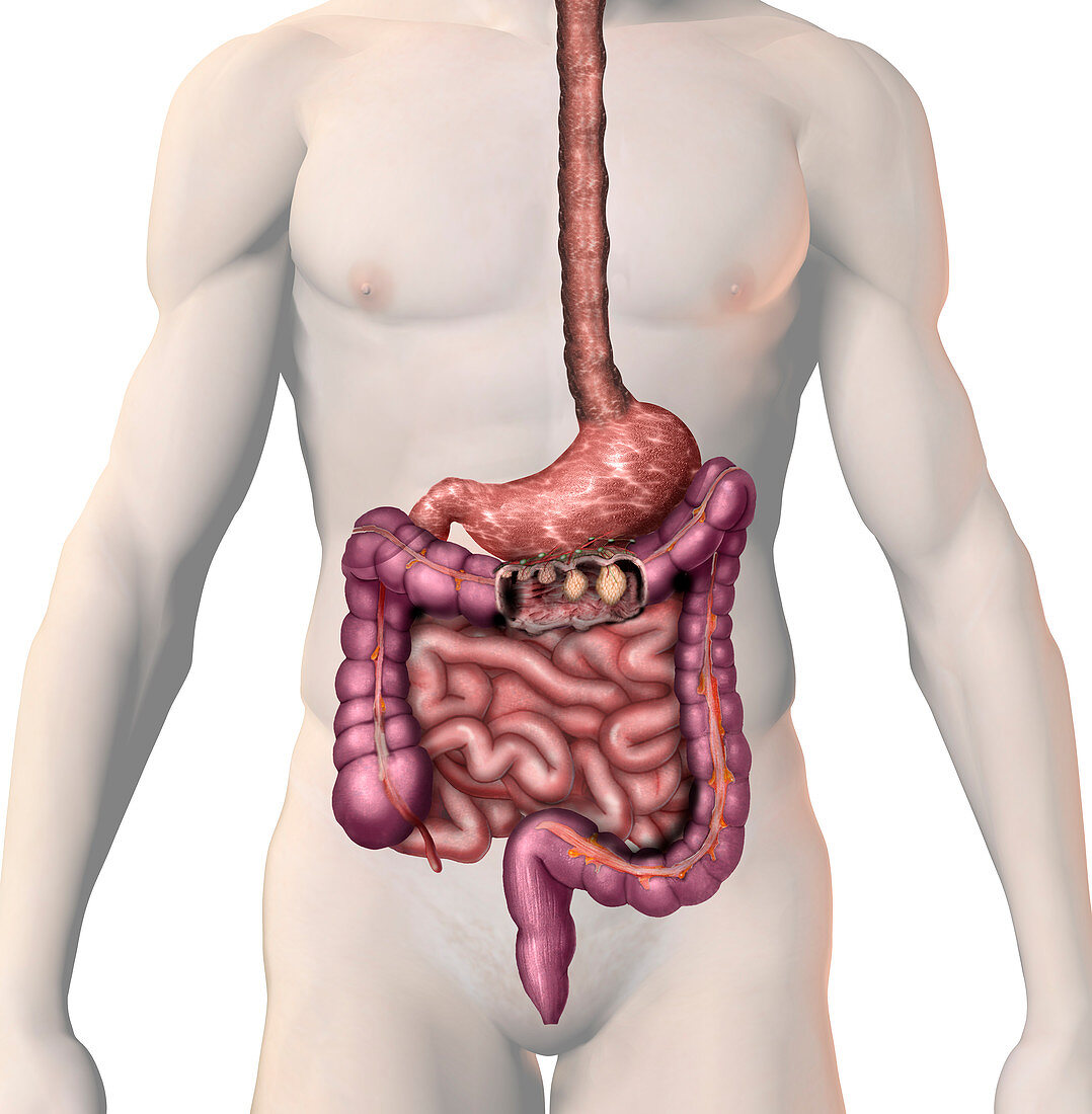 Colon Cancer,illustration