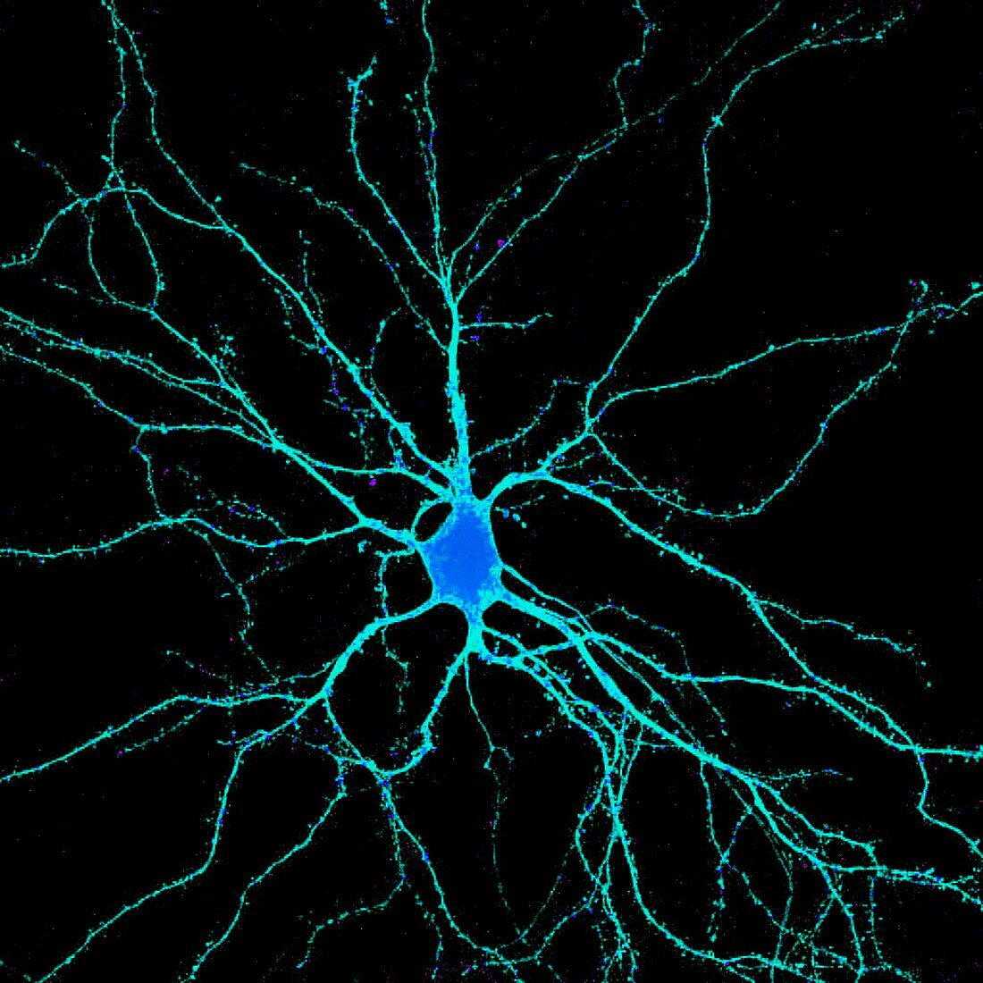 Neuron,fluorescence micrograph