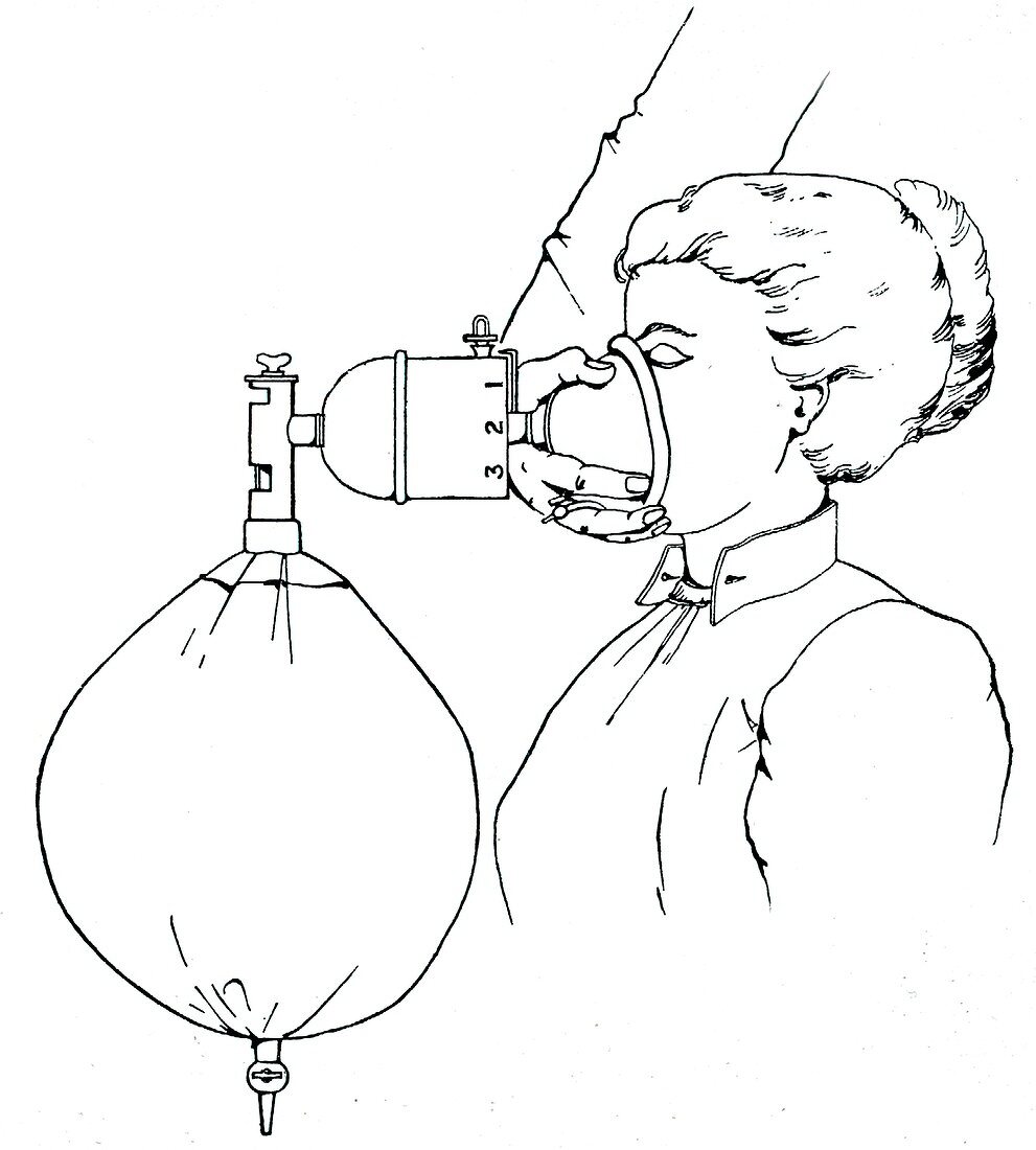 Administering gas and ether