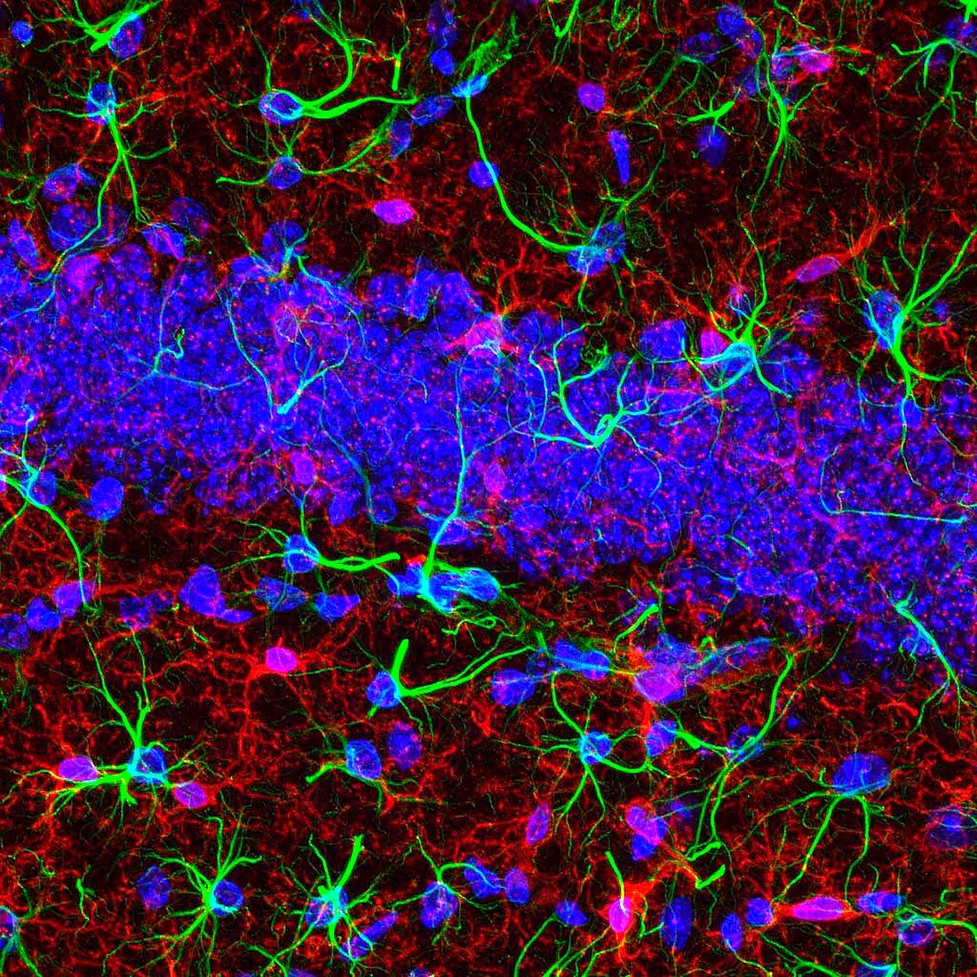 Brain cells,fluorescence micrograph