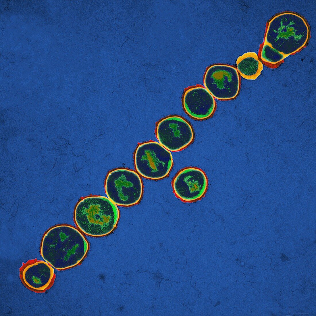 Streptococcus pyogenes bacteria,TEM