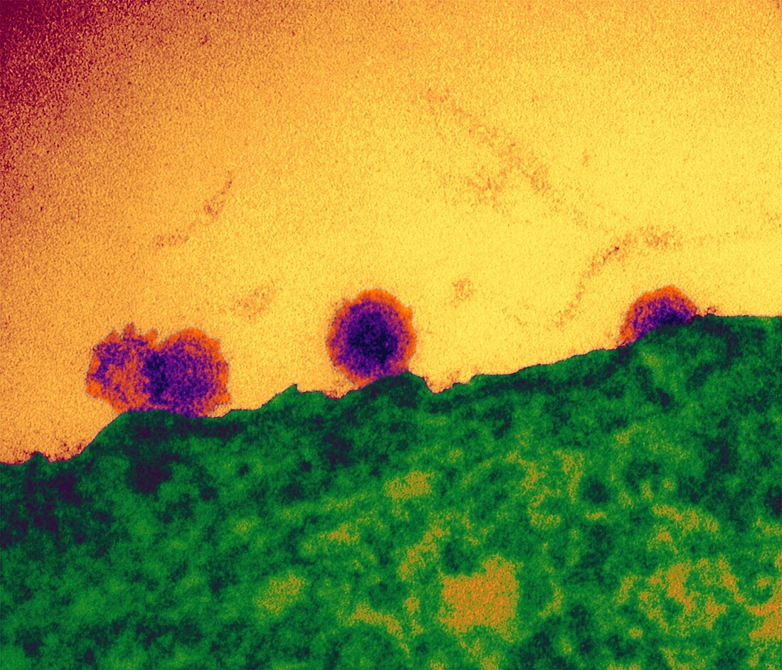 Chikungunya virus particles budding