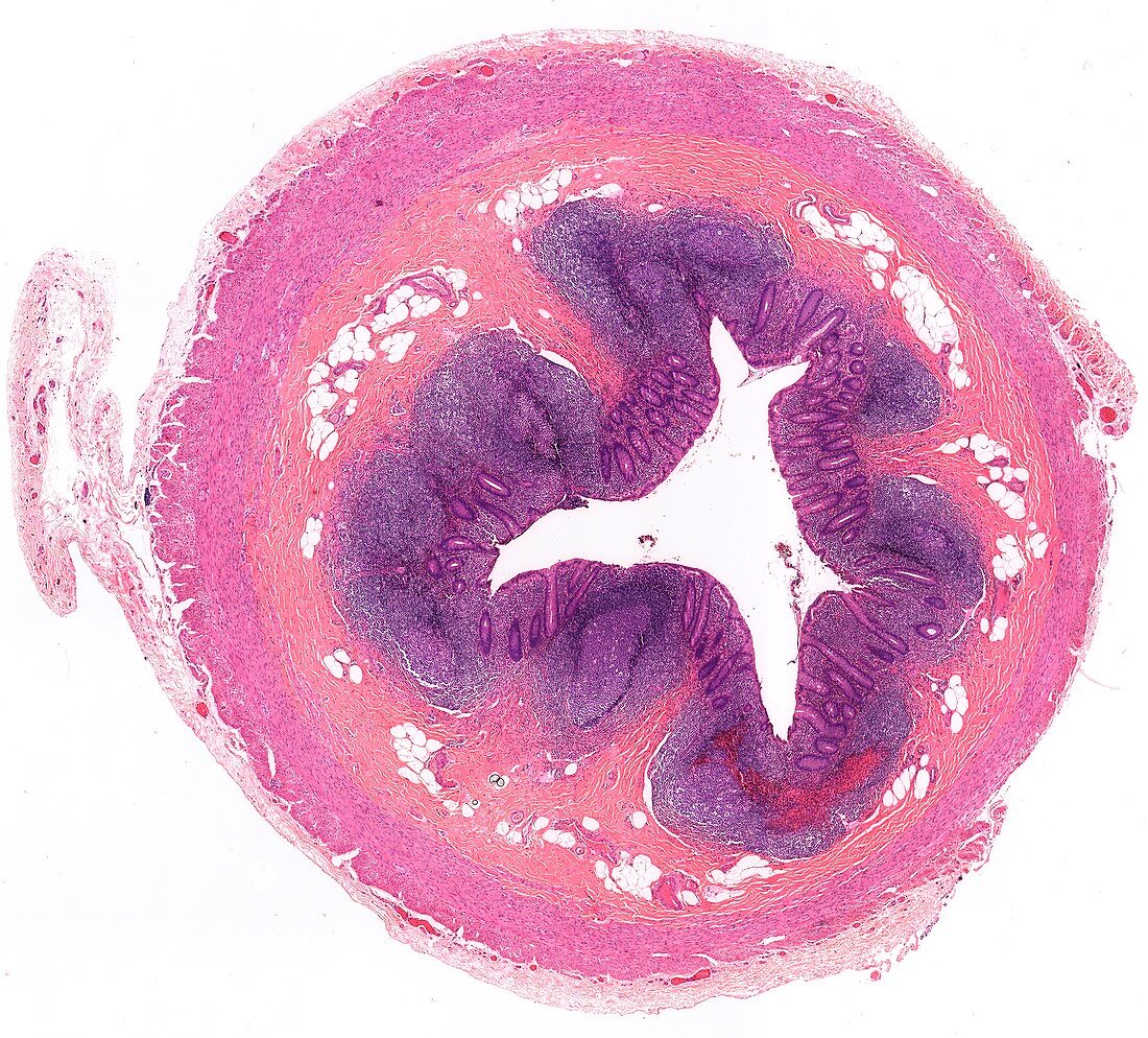 Appendix,light micrograph