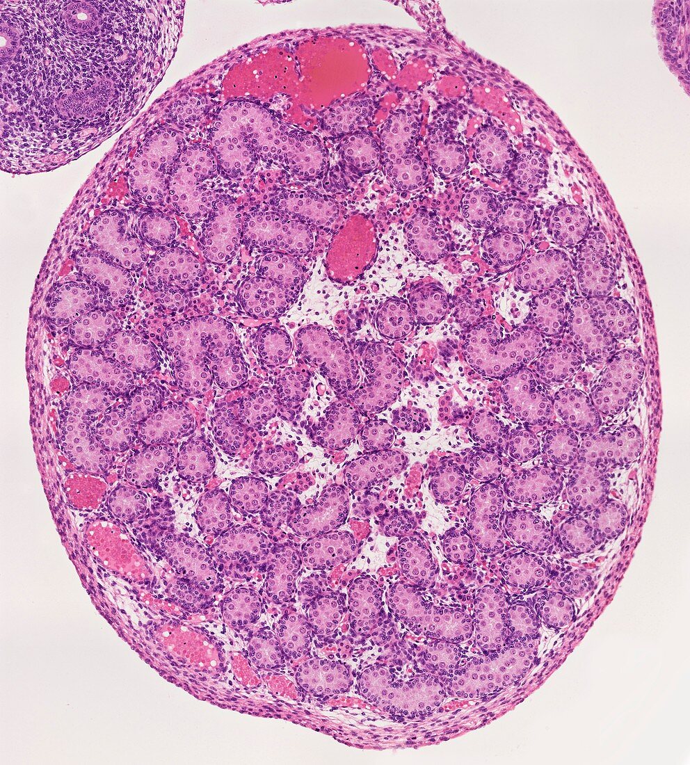 Fetal testis,light micrograph