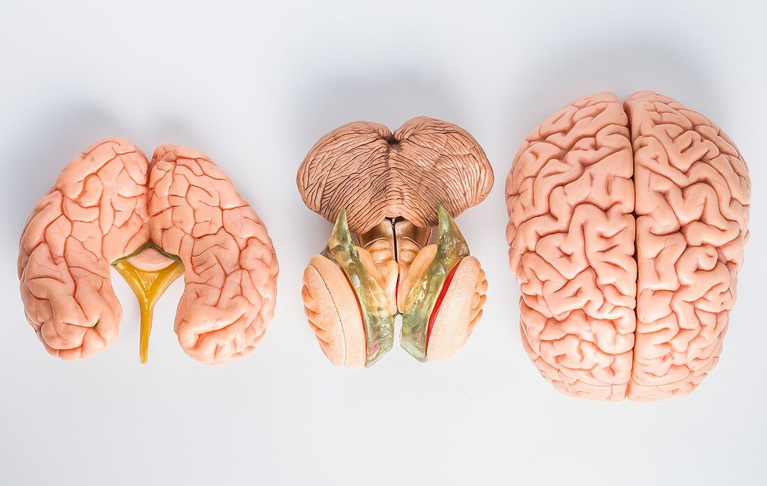 Anatomical model of the human brain