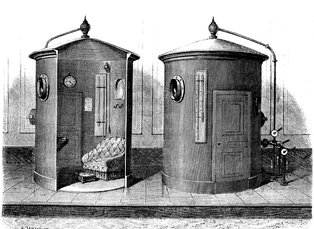 Compressed air baths,illustration