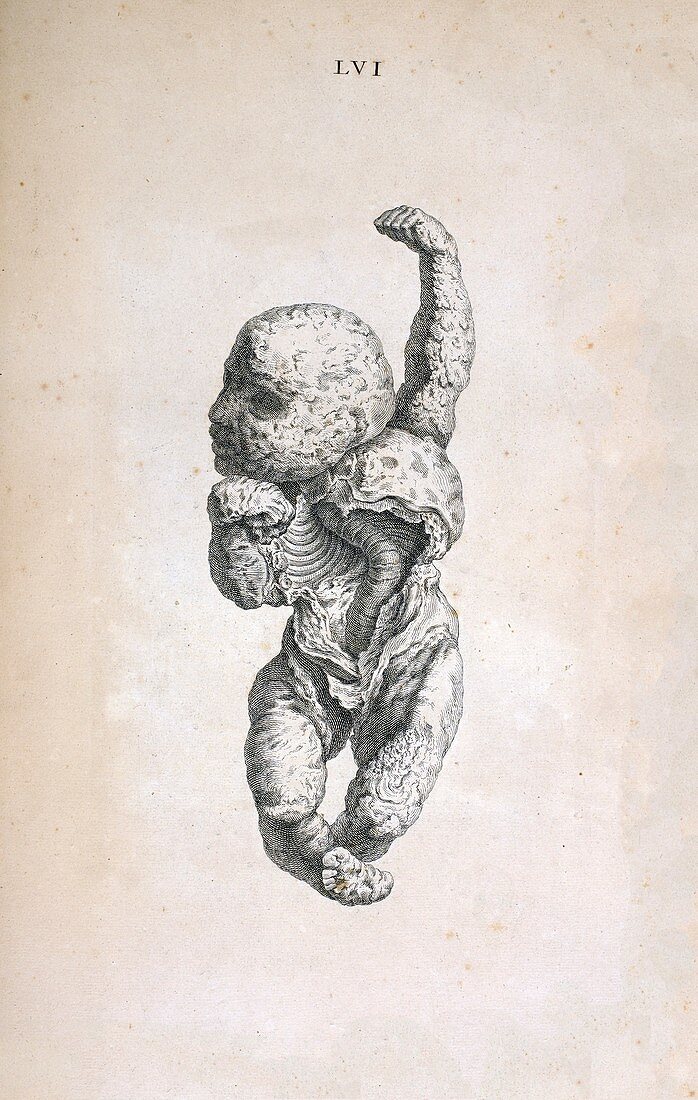 Stone baby,18th century