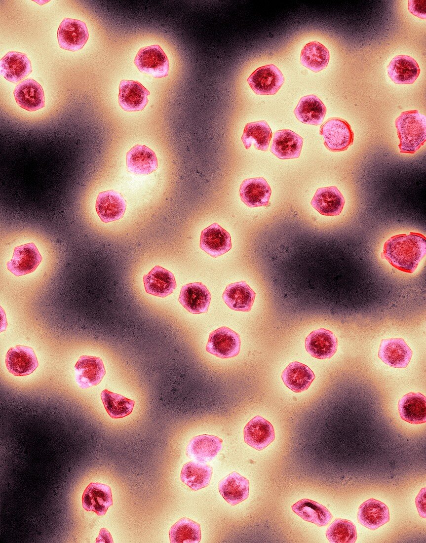 Ranavirus virus particles,TEM