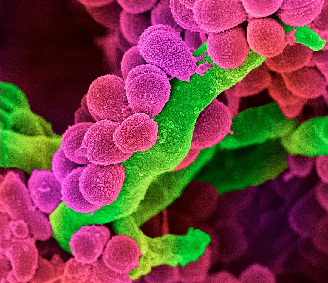 Oral Streptococcus bacteria,SEM