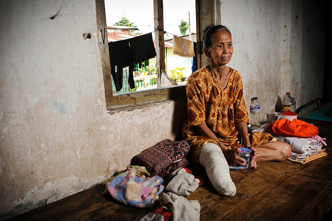 Elderly woman with leprosy,Indonesia