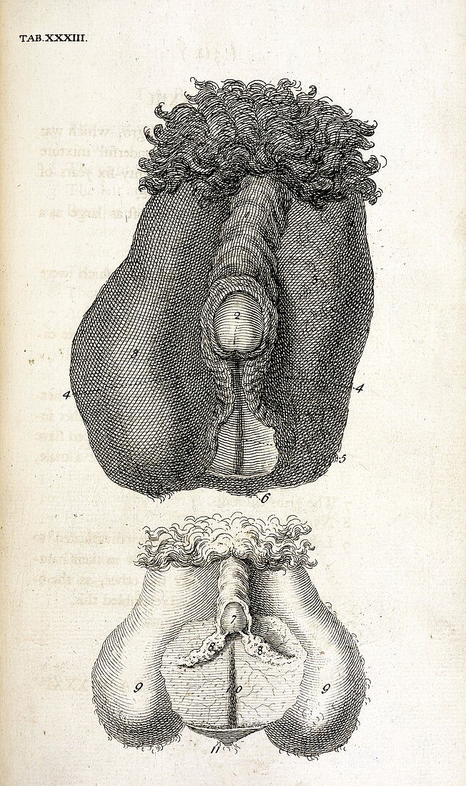 Hermaphrodite sex organs,18th century