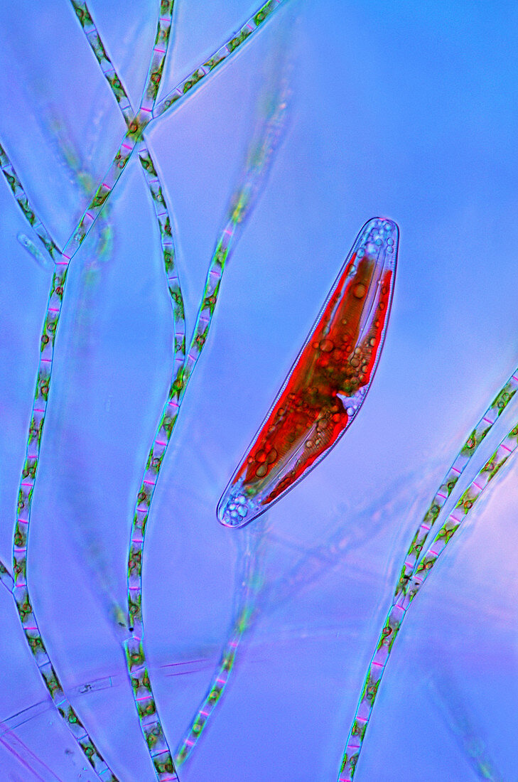 Diatom and green algae,light micrograph