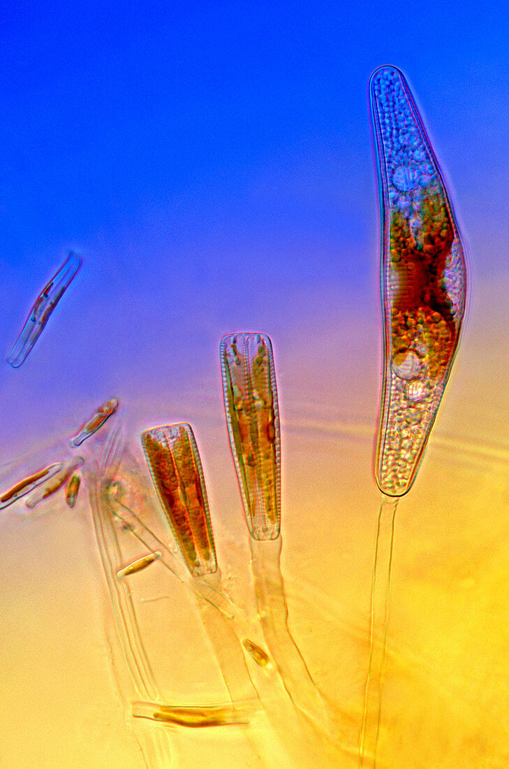 Diatoms,light micrograph