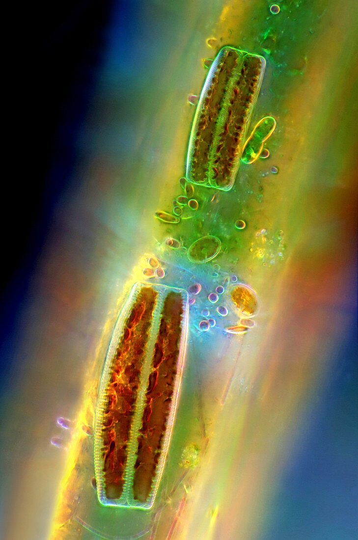 Epithemia diatoms,light micrograph