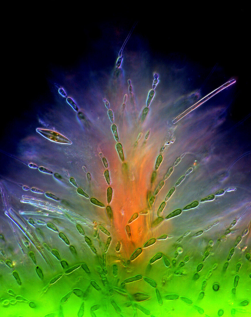 Diatoms on red algae,light micrograph