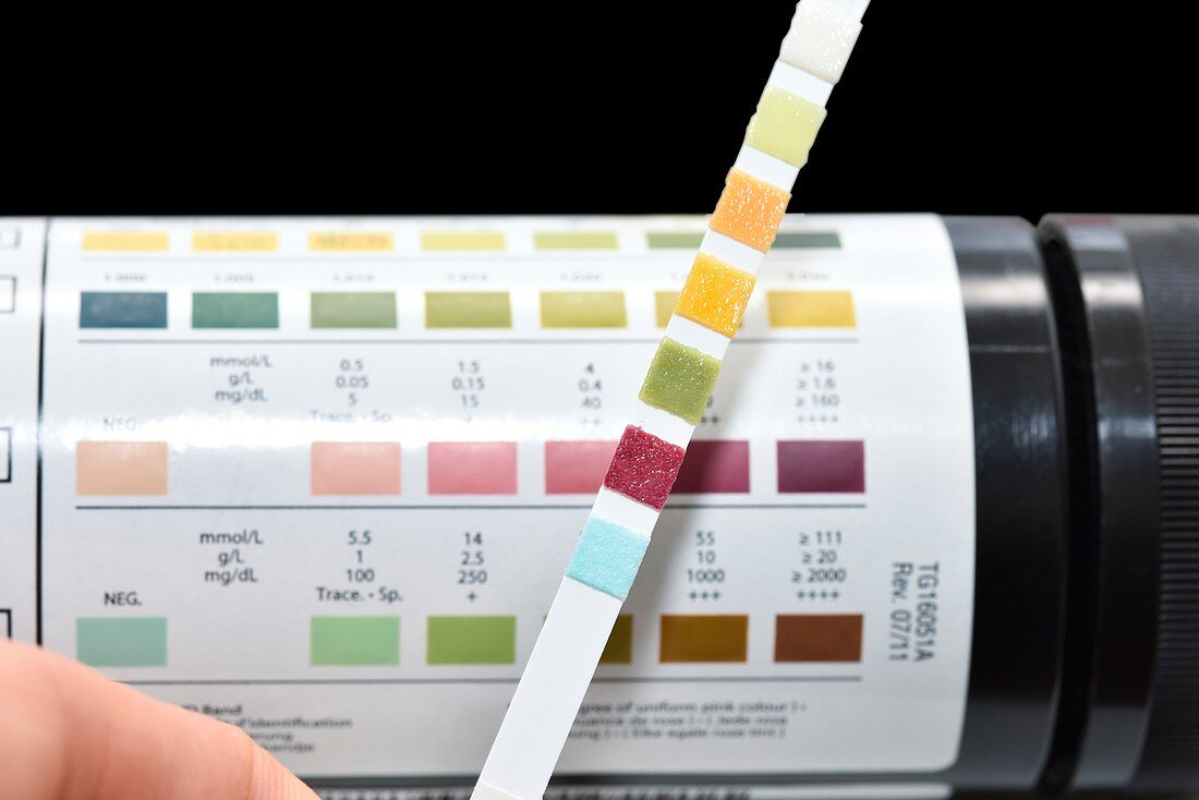 Urine test strip showing ketones