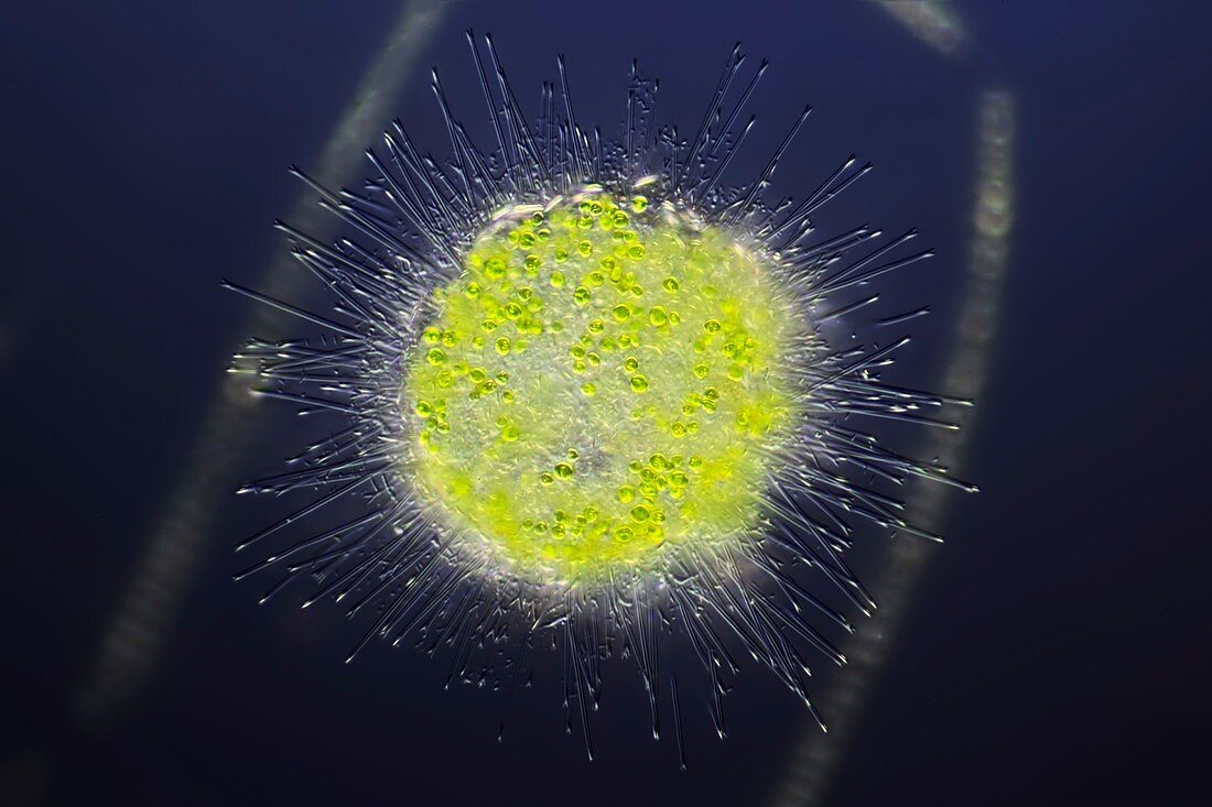 Heliozoa protozoan,light micrograph