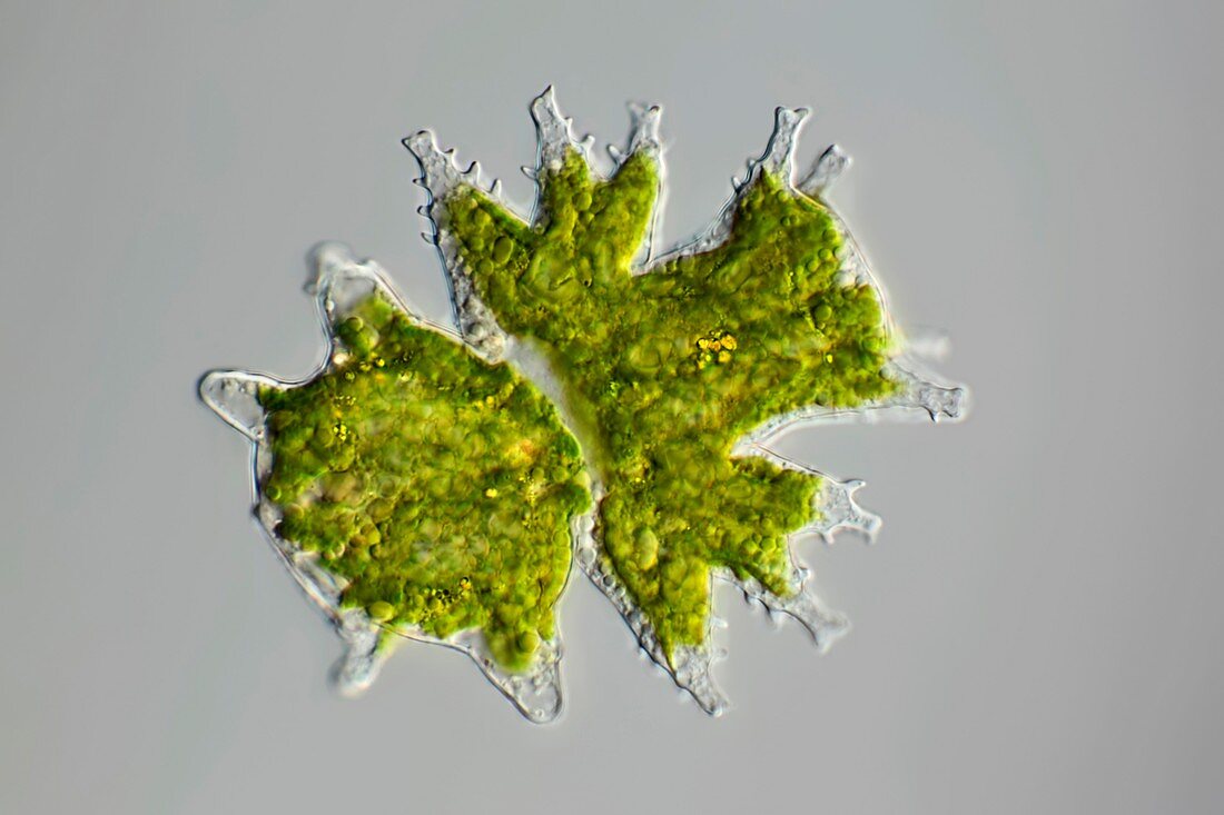 Desmid zygote,light micrograph