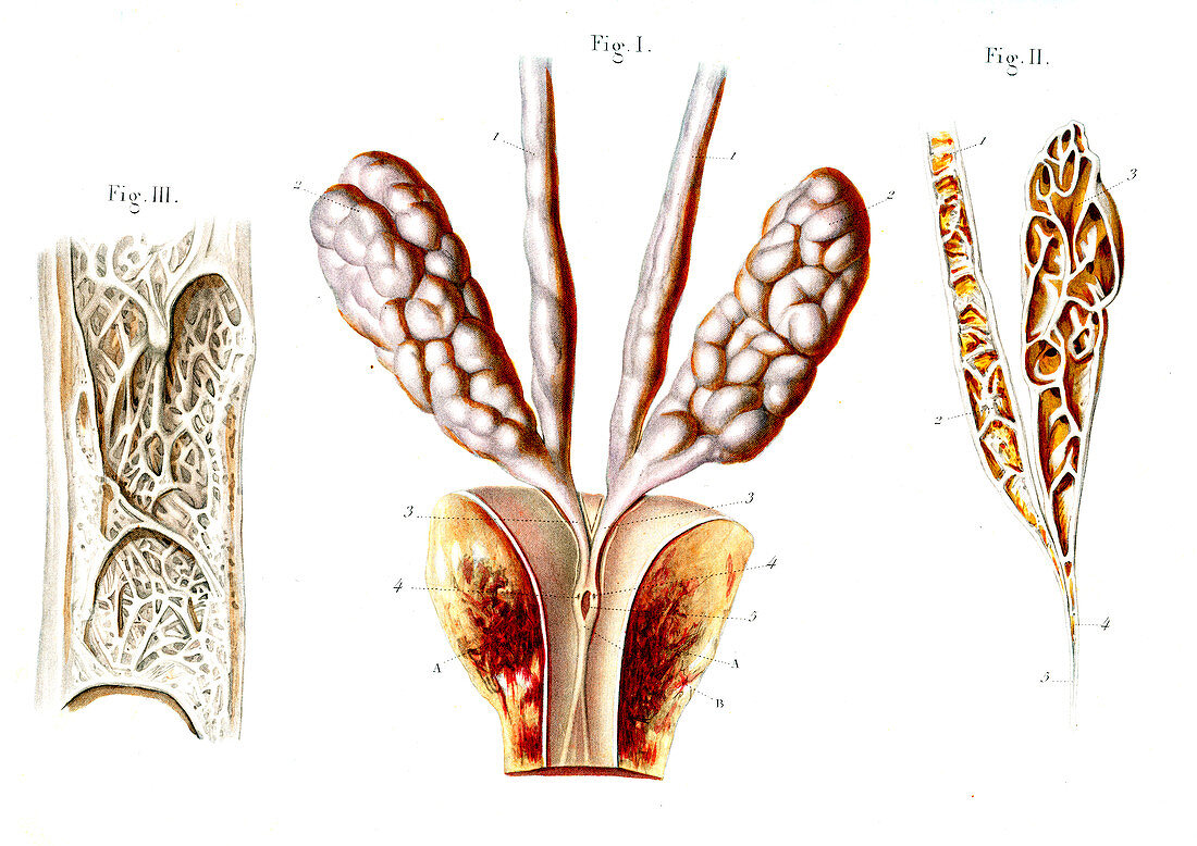 Ejaculatory system,illustration