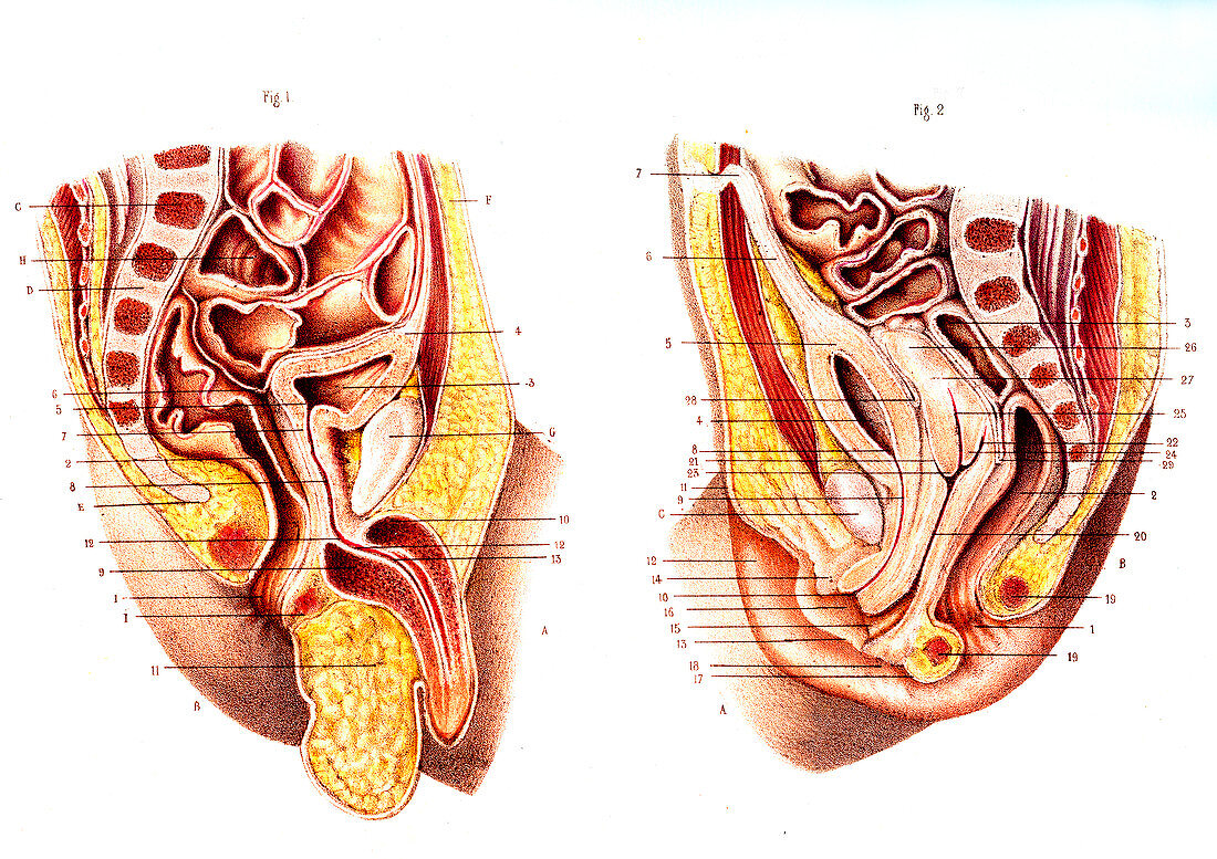 Newborn male & female reproductive organs