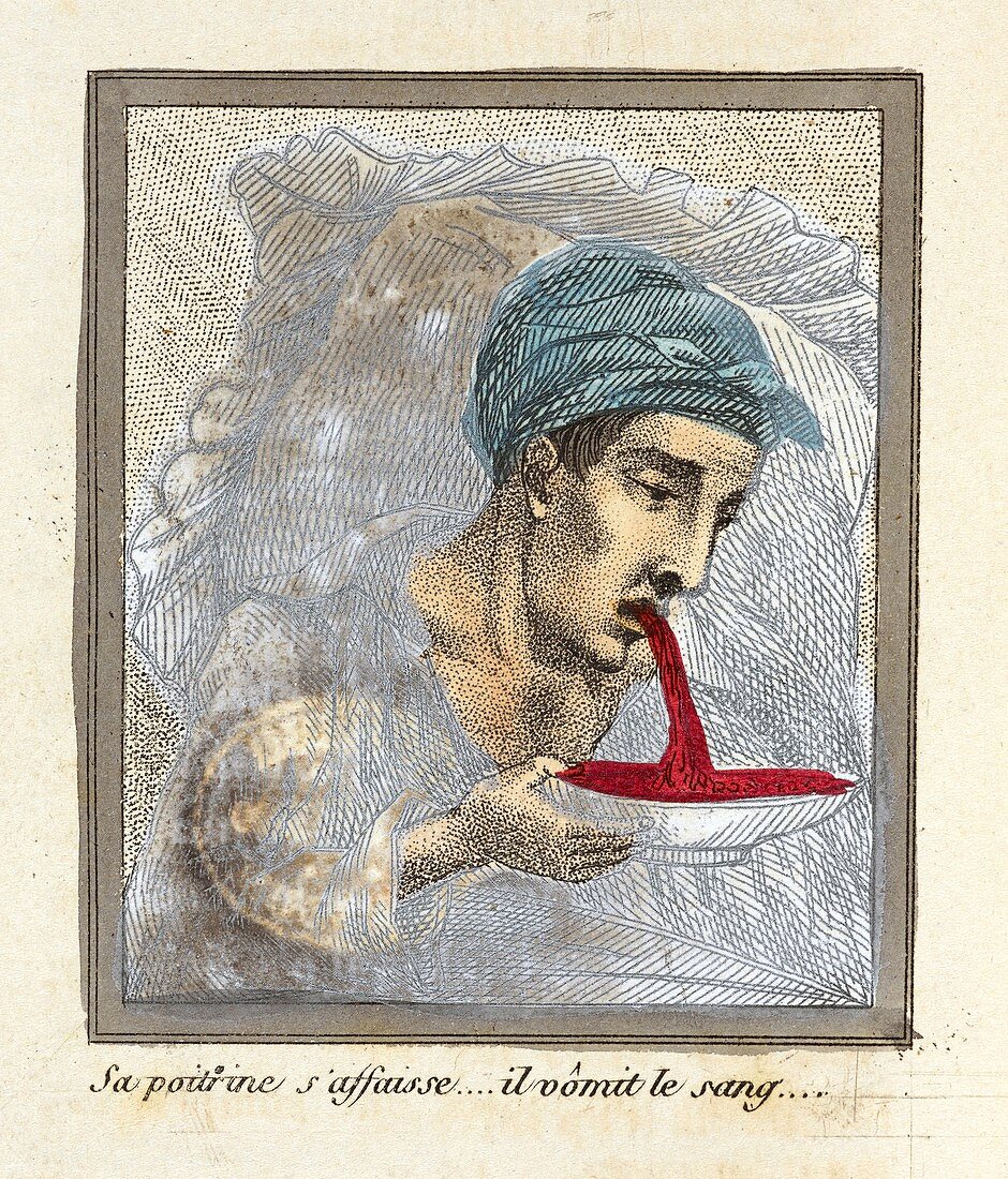 Masturbation health booklet,1830