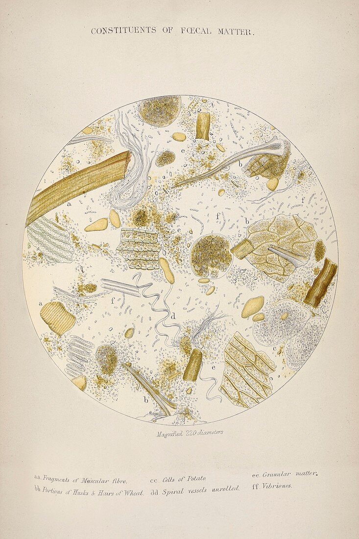 Cholera epidemic research,1855